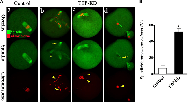 Effects of TTP knockdown on spindle organization and chromosome alignment in oocyte meiosis.