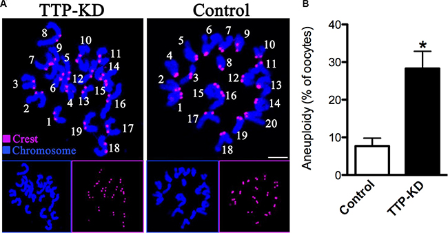 Increased aneuploidy in oocytes loss of TTP.