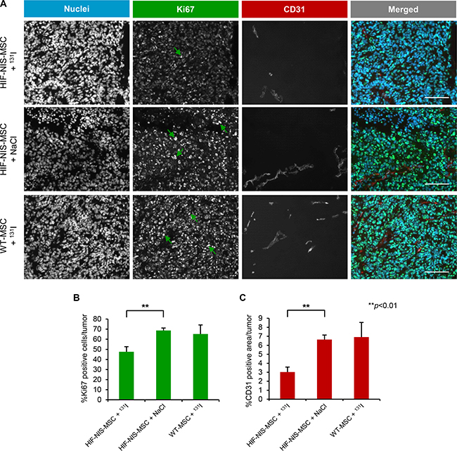 Reduced cell proliferation and blood vessel density in intrahepatic HCC tumors after application of a therapeutic dose of radioiodide in HIF-NIS-MSC-treated mice.