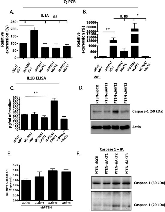 IL1B expression, cleavage and release in PTEN/AKT2 depleted fibroblasts.