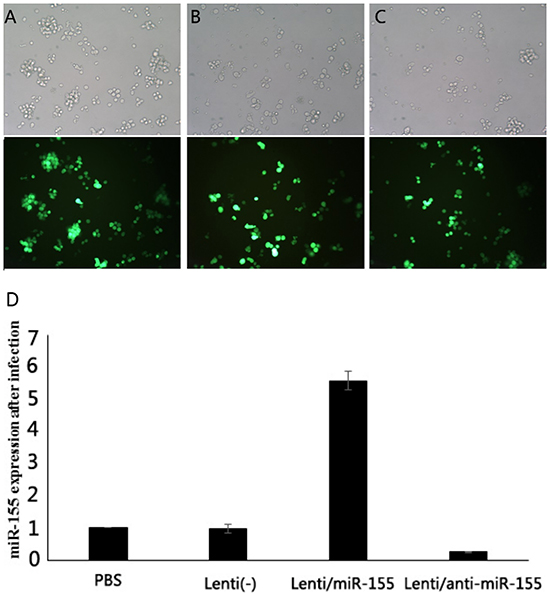 Fluorescence microscopy of GFP expression in infected human lymphoma cells.
