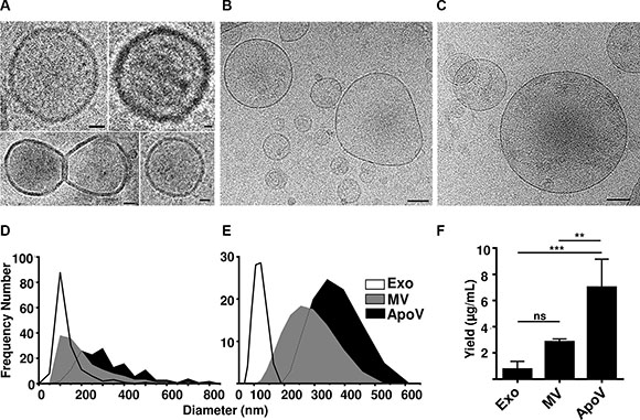 Cryo-electron microscopy, size range and yield of B16-F1-derived vesicles.