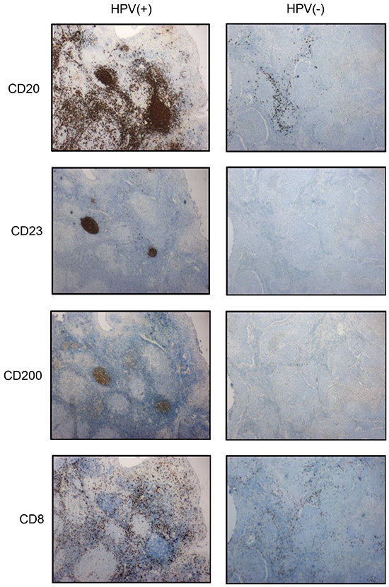 Expression of B-cell markers by IHC.