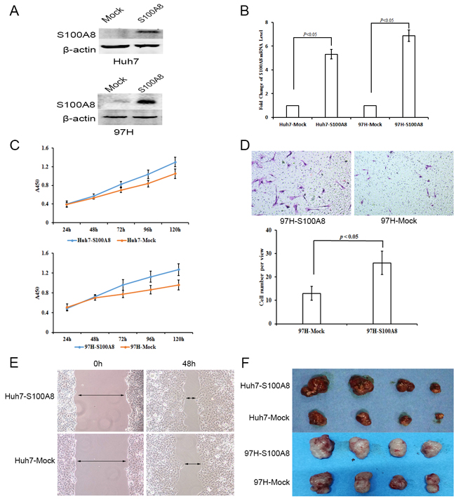 The functional importance of S100A8 in Huh7 and MHCC-97H hepatocellular carcinoma cells.