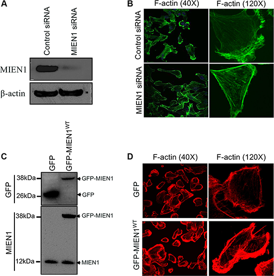 MIEN1 regulates actin-rich membranes protrusions during cell migration.