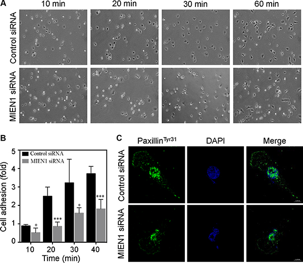Depletion of MIEN1 affects focal complex turnover and cell adhesion.