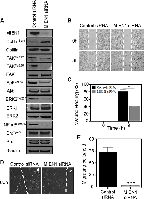 MIEN1 depletion inhibits the cell motility and associated signaling in breast cancer cells.