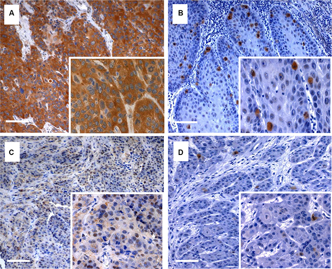 Immunohistochemical staining of Plk3 and pT273 caspase-8.