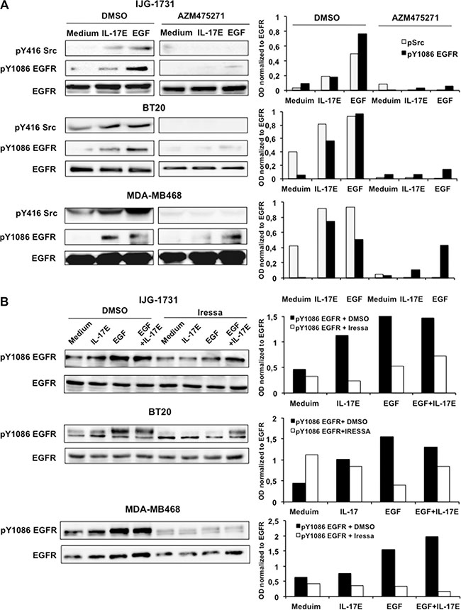 IL-17E-induced EGFR phosphorylation is dependent on Src and EGFR kinase activity.