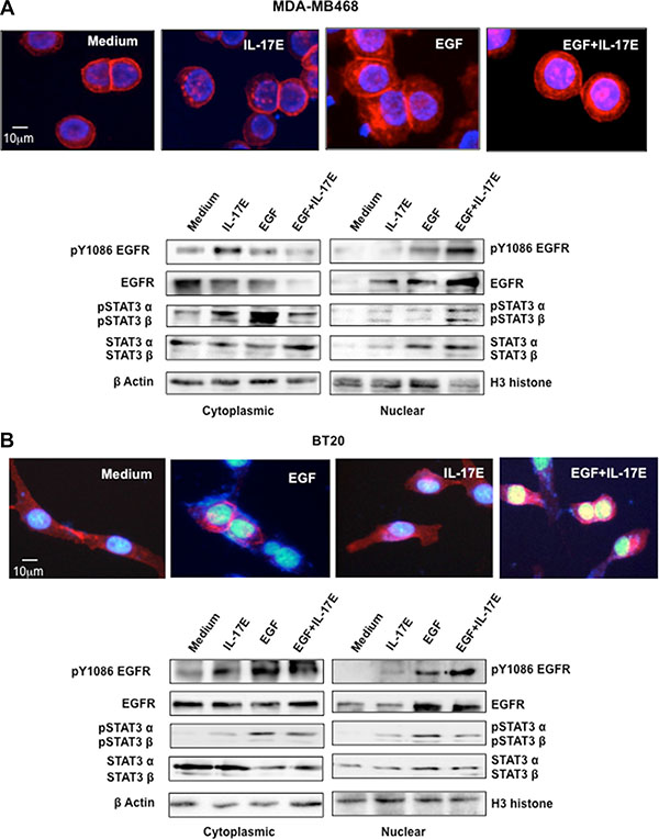 IL-17E facilitates pEGFR and pSTAT3 co-translocation to the nucleus.