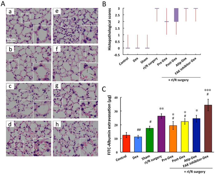 Dexmedetomidine prevents rI/R induced lung injury and pulmonary microvascular hyper-permeability