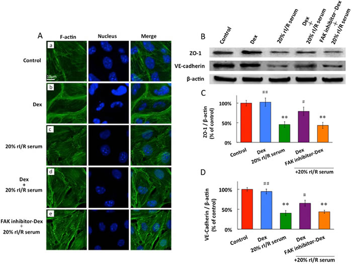 The effects of rI/Rserum on F-actin cytoskeletal assembly