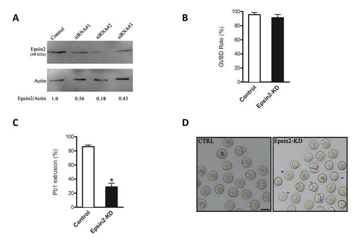 Disturbed meiotic progression in Epsin2-knockdown oocytes.