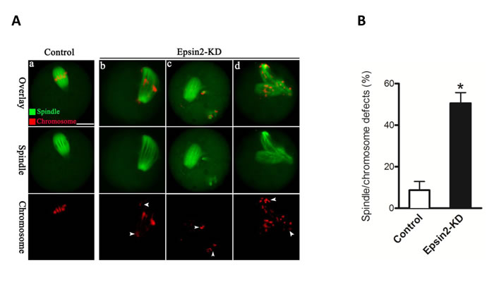 Epsin2 knockdown results in spindle defects and chromosome misalignment in oocyte meiosis.