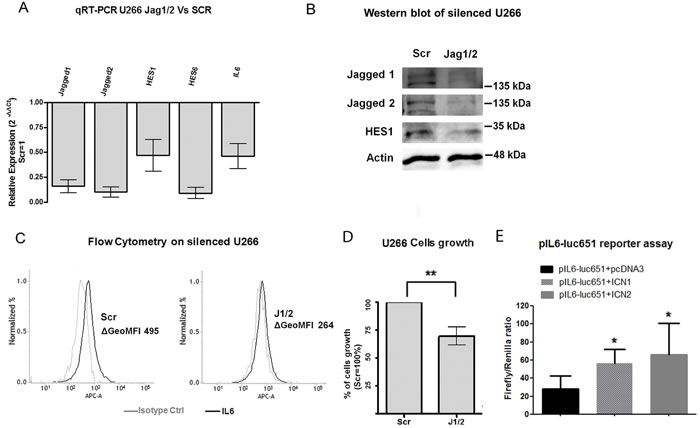 Notch drives MM cell-autonomous production of IL-6 and stimulates their proliferation.