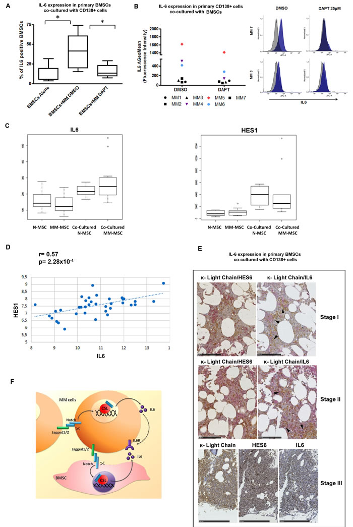 Inhibition of NOTCH signaling abrogates myeloma-induced IL-6 production by BMSCs