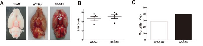 SAH grade and overall mortality.