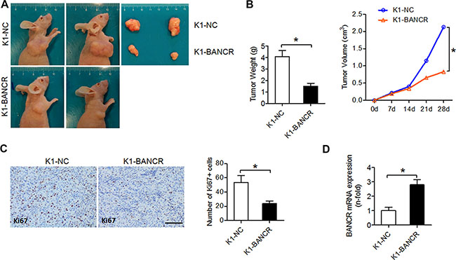 BANCR inhibits tumor growth in vivo.
