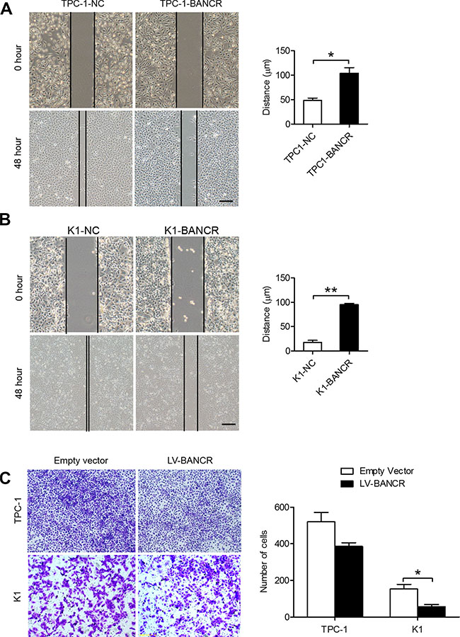BANCR overexpression inhibits PTC cell migration and invasion in vitro.