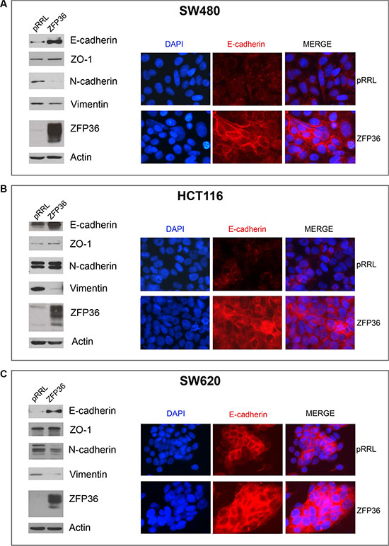 Analysis of epithelial markers in ZFP36 overexpressing cells.