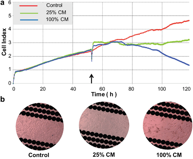 Real-time assessment of conditioned medium (CM)-induced cytotoxicity in DBTRG cells.