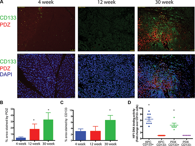 Hypoxia enriches for CD133+ cells in pancreatic cancer.