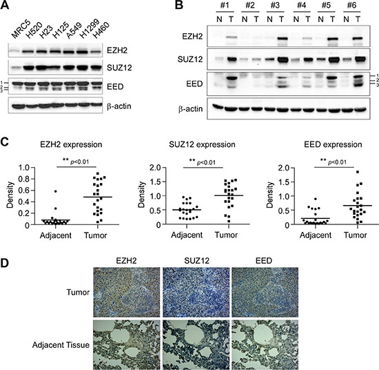 Aberrant overexpression of PRC2 proteins EZH2, SUZ12 and EED in human non-small cell lung cancer.
