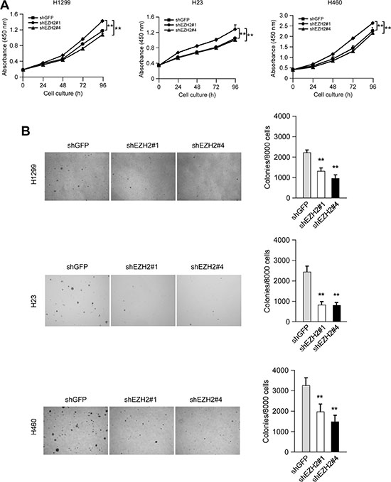 Knocking down the PRC2 catalytic component EZH2 expression reduces human non-small cell lung cancer cells proliferation in vitro.