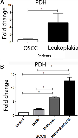 PDH levels in patients and the effect of metformin on PDH levels in SCC9 cells.