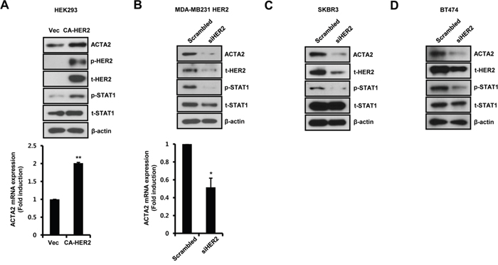 Alteration of HER2 expression regulates ACTA2 expression.