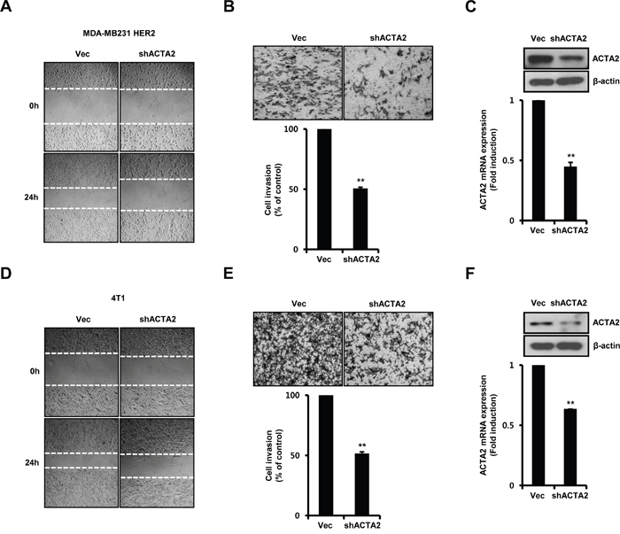 ACTA2 silencing decreases breast cancer cell motility.