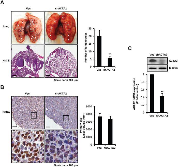 ACTA2 silencing decreases the metastatic potential of breast cancer cells.