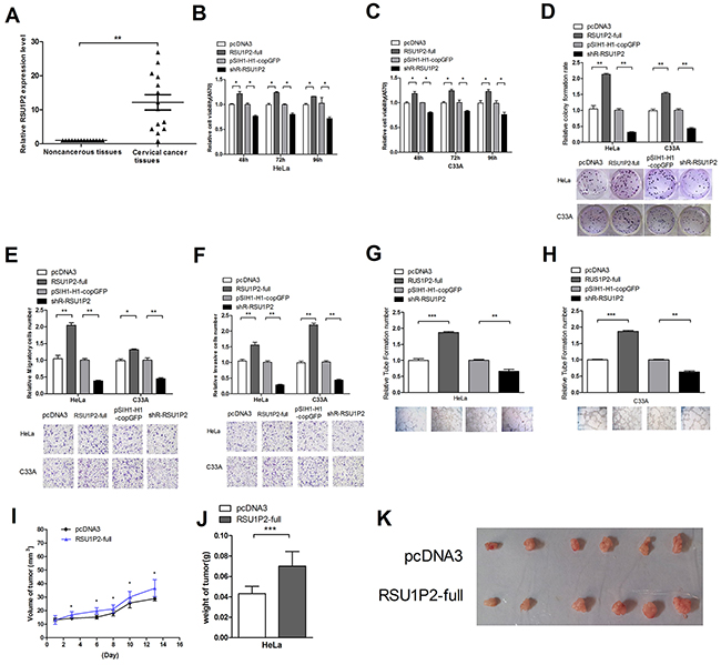 Differential expression of RSU1P2 and RSU1P2 has a growth-promoting role in cervical carcinoma cells.
