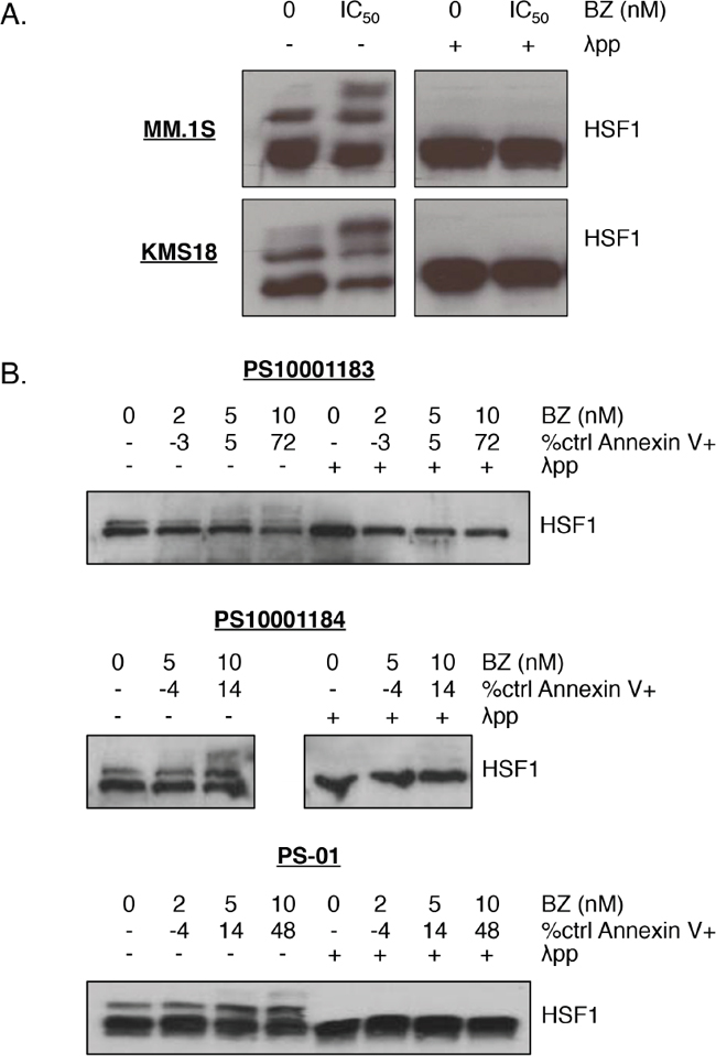 HSF1 is phosphorylated upon bortezomib treatment in multiple myeloma cells.