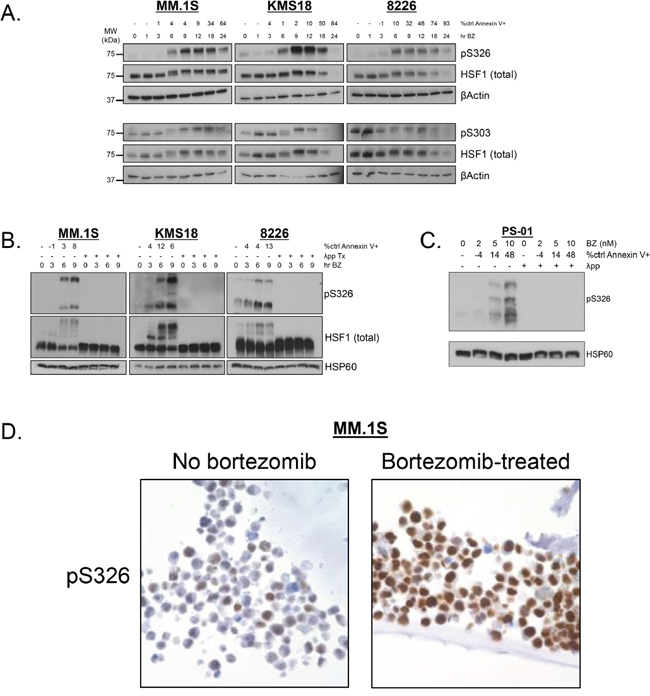 Phospho-specific antibodies confirm that HSF1 serine 326 is a bortezomib-inducible phosphorylation site and serine 303 is a constitutive phosphorylation site.