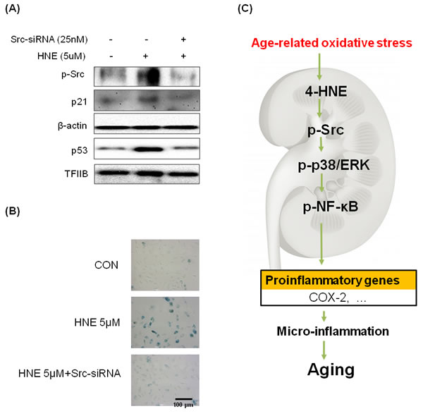 Inhibition of 4-HNE-induced cell senescence by Src-knockdown.