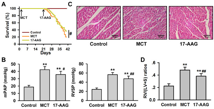 HSP90-inhibition alleviates MCT-induced PH.