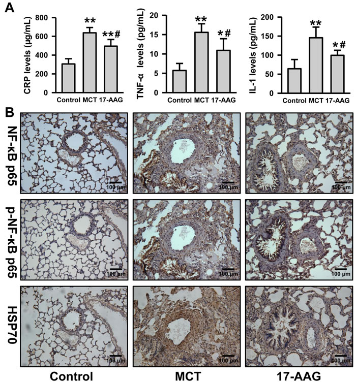 Inhibition of HSP90 decreased inflammatory and NF-&#x3ba;B signaling in PH.