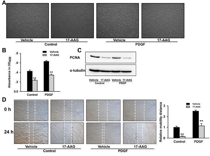 Inhibition of HSP90 reduced PASMCs proliferation and migration induced by PDGF-bb.