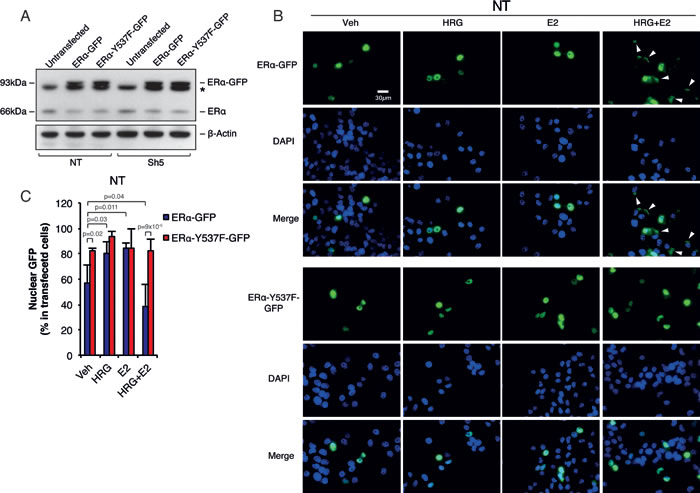 Memo controls ER&#x3b1; extra-nuclear localization through ER&#x3b1;-Y537 phosphorylation.