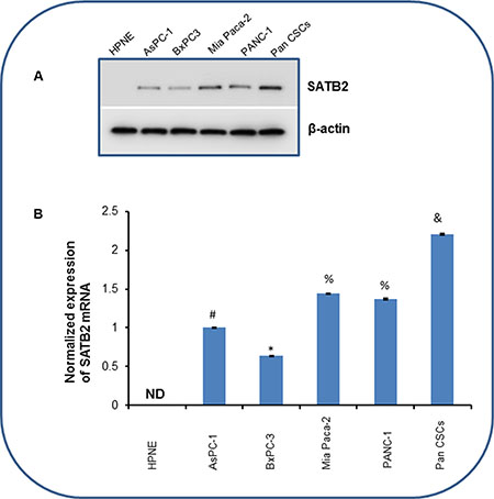 The expression of SATB2 in HPNE, pancreatic cancer cell lines and pancreatic CSCs.