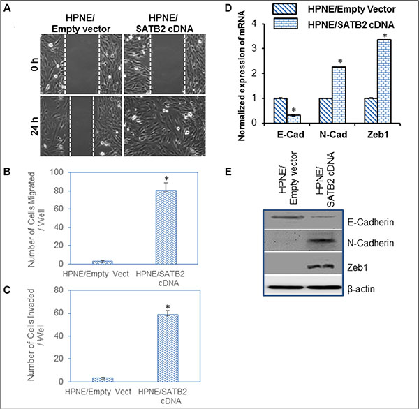 Overexpression of SATB2 in HPNE cells induces EMT characteristics.