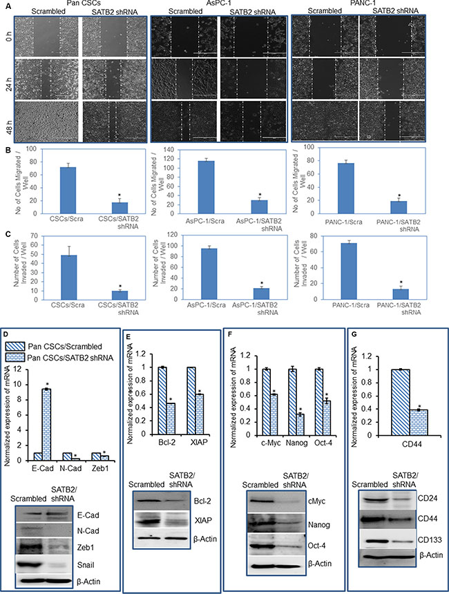 Knockdown of SATB2 in pancreatic cancer cell lines inhibits epithelial-mesenchymal transition, and markers of cell proliferation, pluripotency and stem cells.