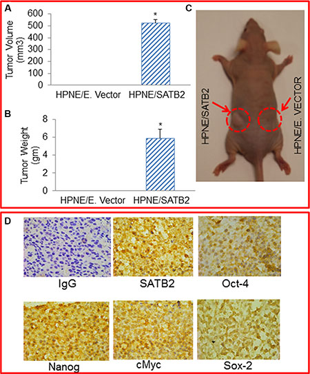 SATB2 overexpressing HPNE cells formed tumors in Balb C Nude mice.