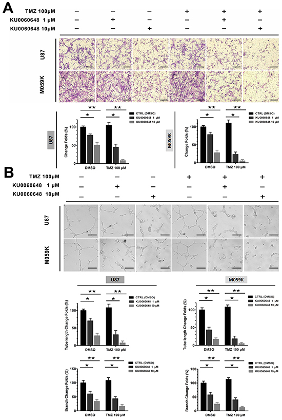 Effects of combination treatment of KU0060648 and TMZ on the invasion and angiogenesis of glioma cells.