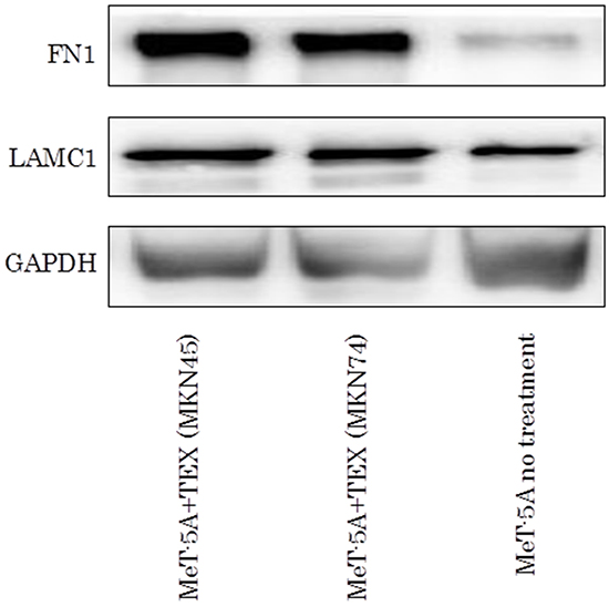 The western blotting assay of FN1 and LAMC1 in TEX-internalized MeT-5A cells.