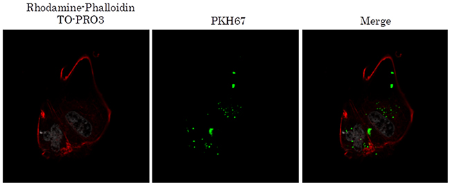 TEX from malignant pleural effuseon internalized into mesothelial cells.