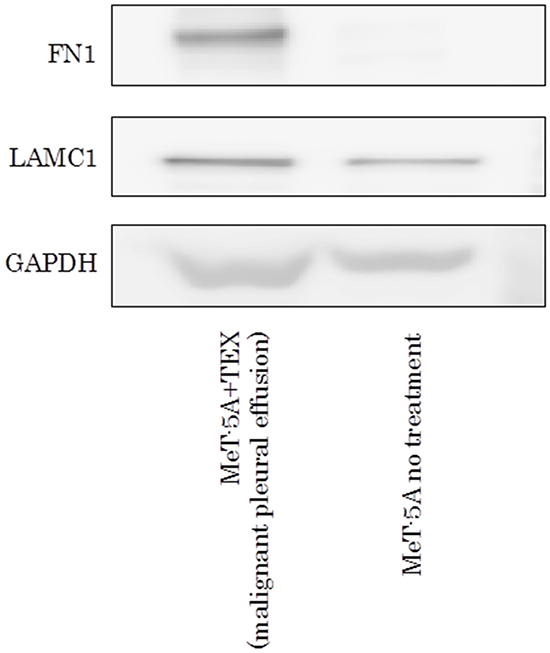 Western blotting assay of FN1 and LAMC1 in MeT-5A ingested TEX from malignant pleural effusion.