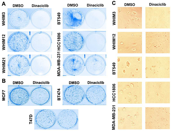 Dinaciclib inhibits cell proliferation of TNBC more effectively than that of ER&#x002B; breast cancer.