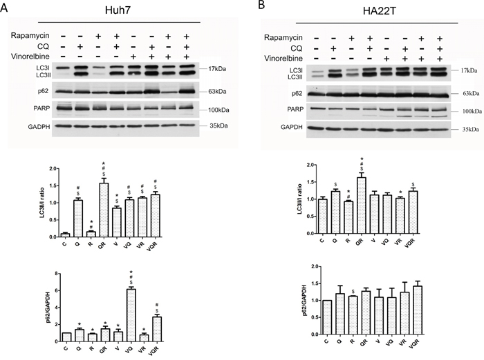 Western blot analysis of autophagy markers LC3II and p62 and apoptosis marker PARP in hepatoma cells after combination drug treatment.